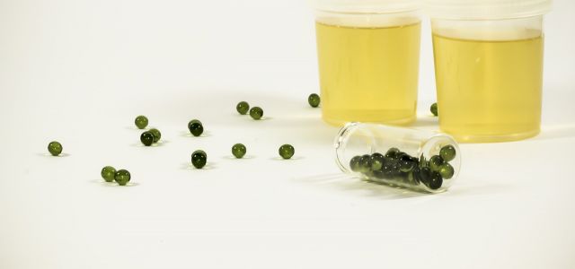urine1-640